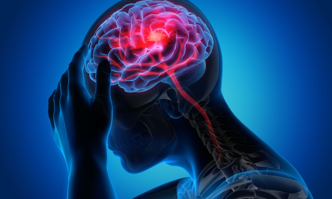 Migraine Treatment Doctor in Dhamtari